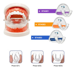 Invisible Teeth Aligners