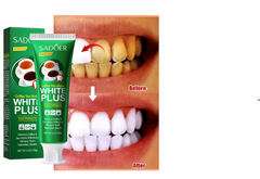 Teeth Whitening Toothpaste (100g)